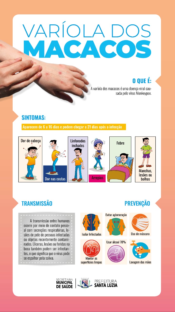 Varíola dos macacos: sintomas e prevenção - Saúde - Estado de Minas